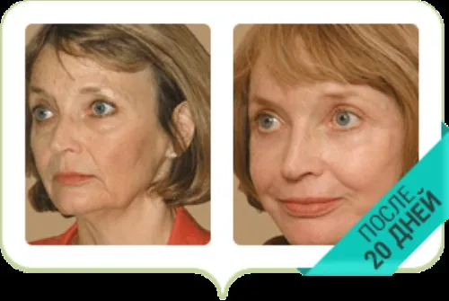 Carattia cream : sestava samo naravne sestavine.